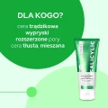 maseczka-z-kwasem-salicylowym-na-tradzik